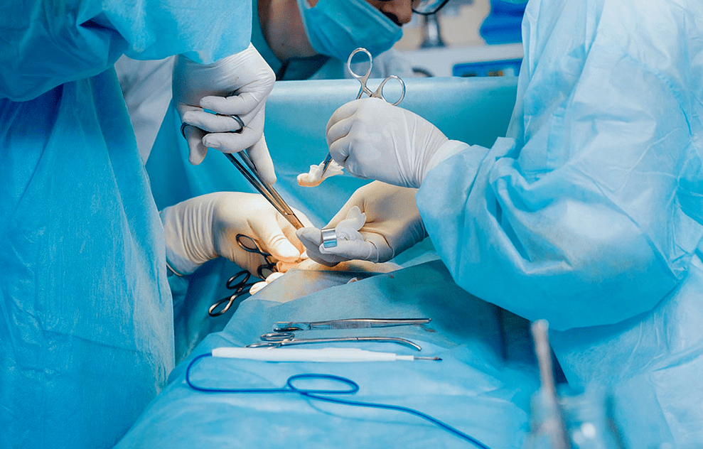 zakila handitzeko metodo kirurgikoa